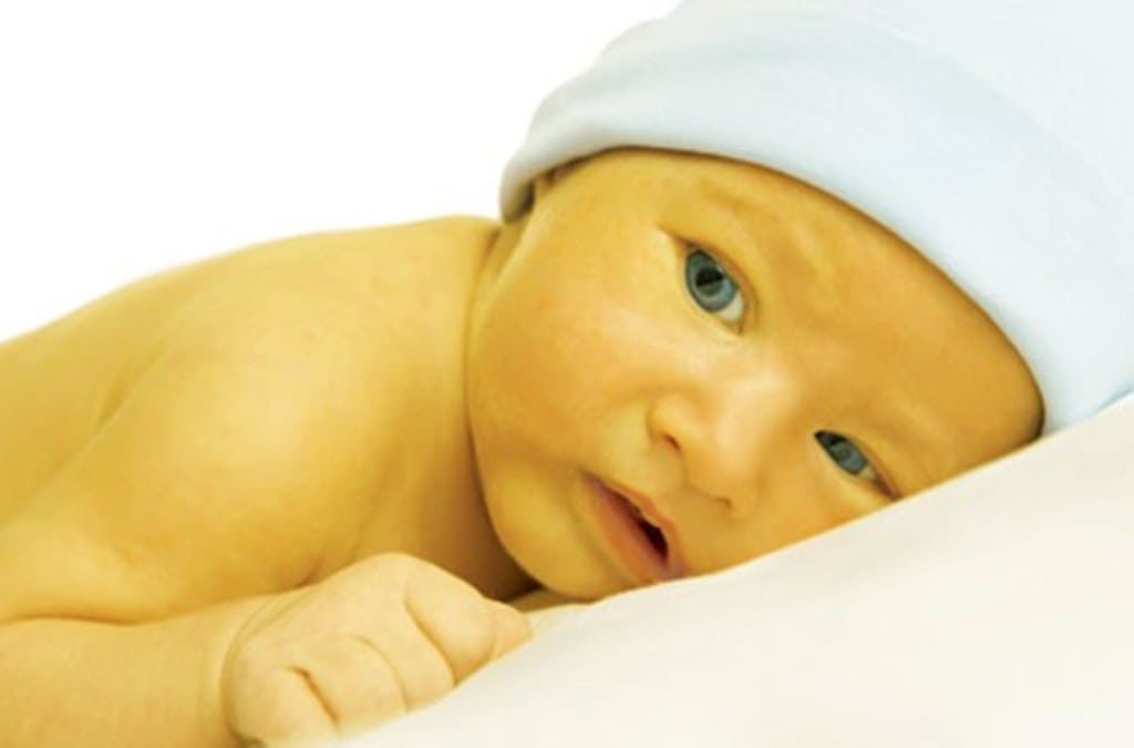Ictericia neo natal sintomas e tratamentos